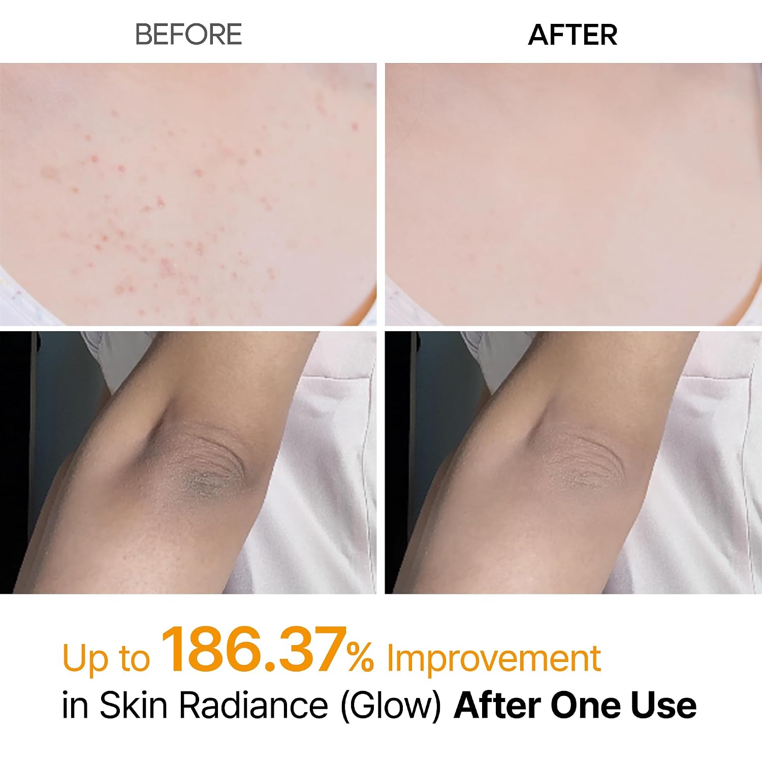 Peel Shot Kojic Acid Turmeric Body Exfoliator Spray 6.76 Fl.Oz